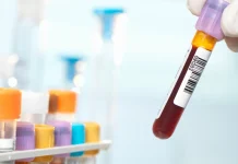 นักวิทย์ฝรั่งเศสพบกรุ๊ปเลือดชนิดใหม่ที่มีคนเดียวในโลก!