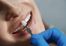 วีเนียร์คืออะไร ต้องรู้อะไรบ้างหลังตัดสินใจทำ